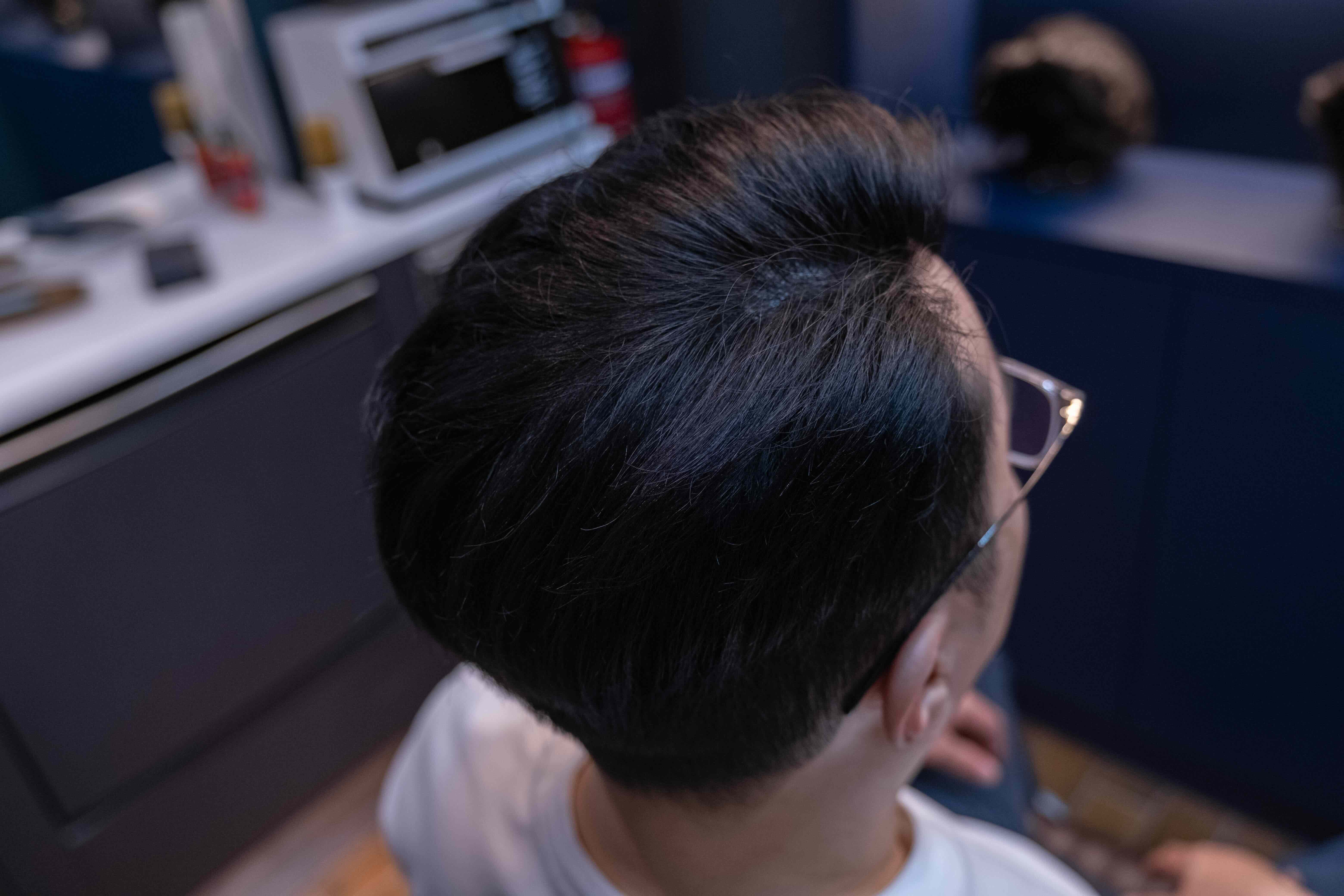 Hair after treatment