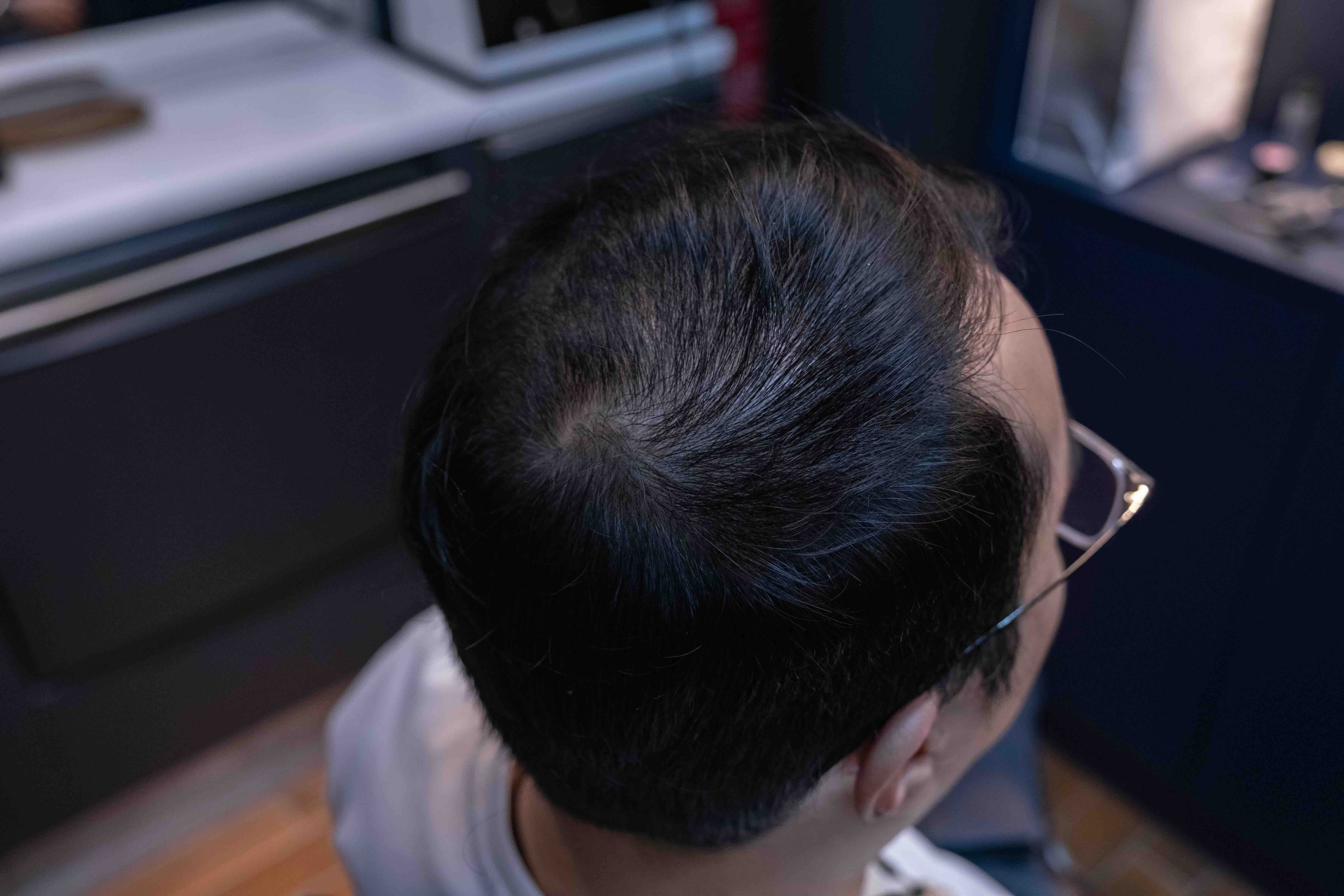 Hair before treatment