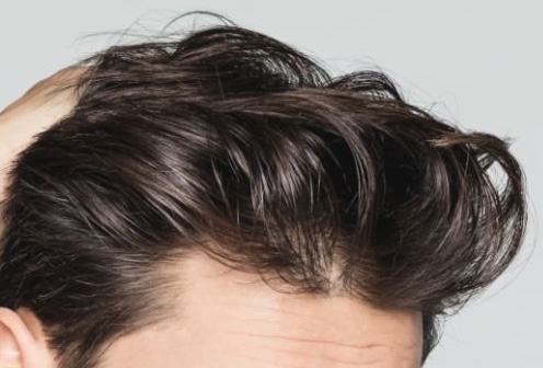 Selection of Hair System