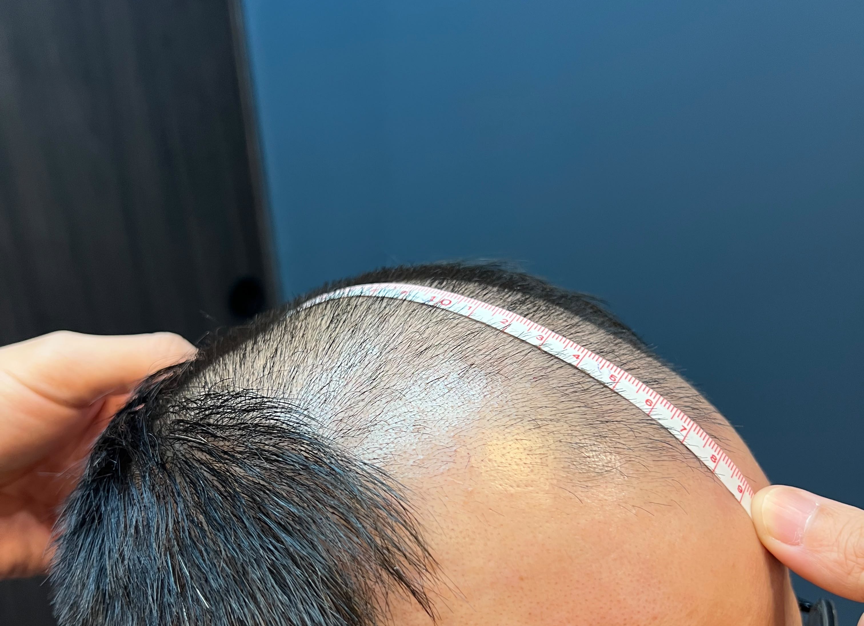 Head Measurement